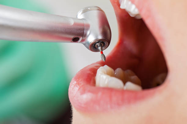 Best Emergency Tooth Extraction  in Tropical Park, FL